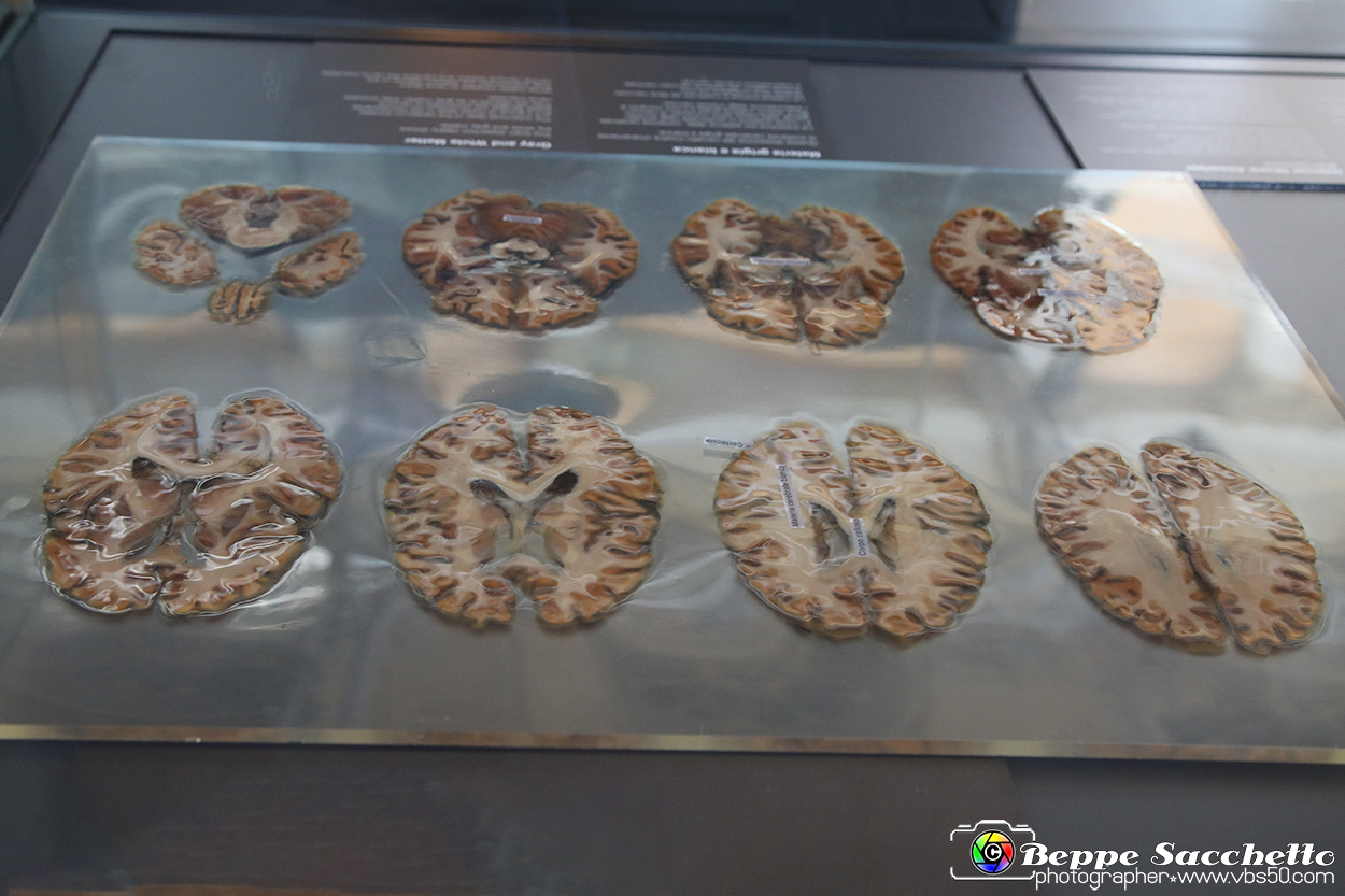 VBS_3002 - Materia grigia e bianca - Mostra Body Worlds.jpg